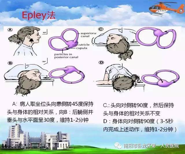 卧龙区第一人民医院内二科这种头晕叫眩晕10分钟手到病除别在治错了