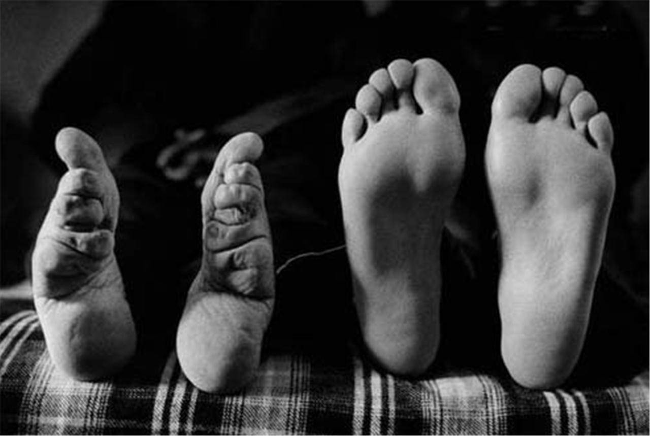 古代"缠足"恶习是何时出现的?如此恐怖为何能够流传长达千年