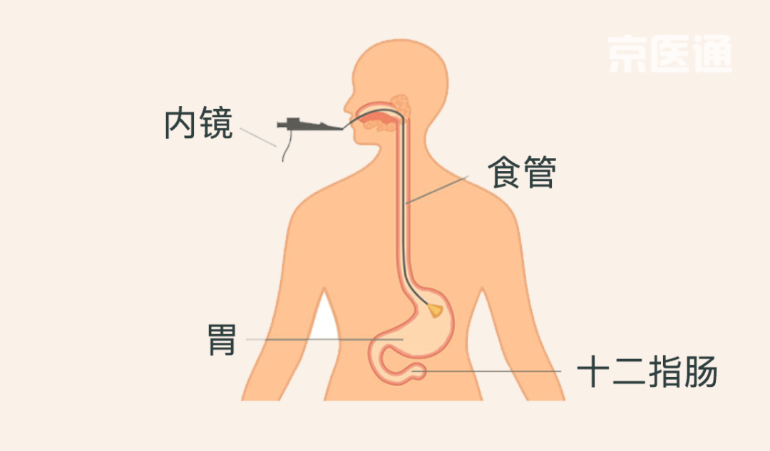 644e3a95feb64a31bb74ac42e10d9cbe.png