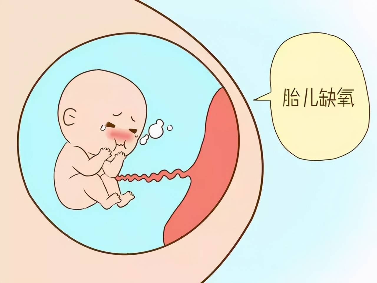 孕期出现某些情况表示胎儿缺氧了孕妈一定要重视哪种情况呢