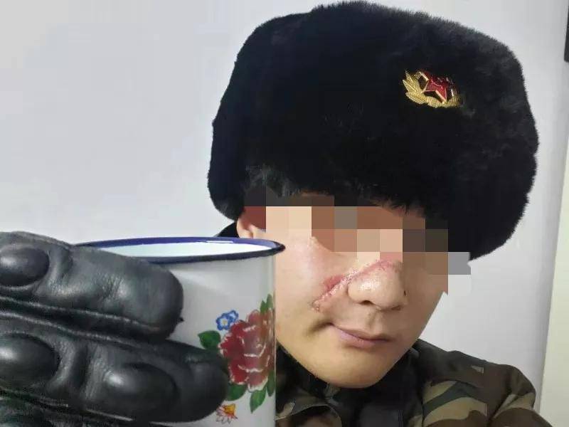 是不接受送检的,那这款蝎子组合盔背后的美国dot安全检验合格标志是