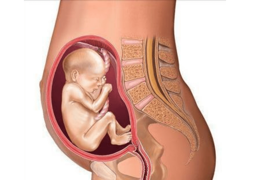 胎儿在子宫趴着的图片图片