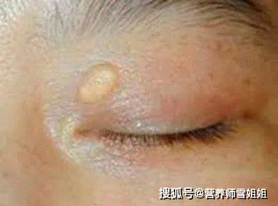 什么运动能快速降低甘油三酯 904ed05de33c4f40be535fac2cfabce6.jpeg