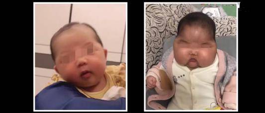 怎么才能变成大头娃娃 b0d733f05d4a49b38f96f66eca0220a5.jpeg