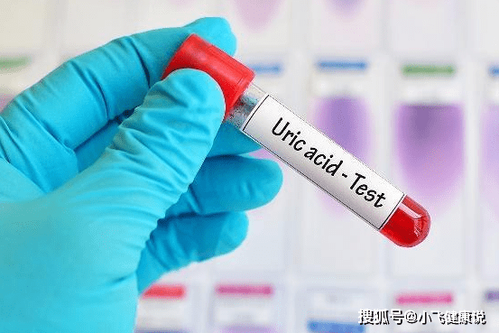 什么食物能降尿酸痛风 80a37fbf8ece4e5d8dceff5e800e5e8c.png