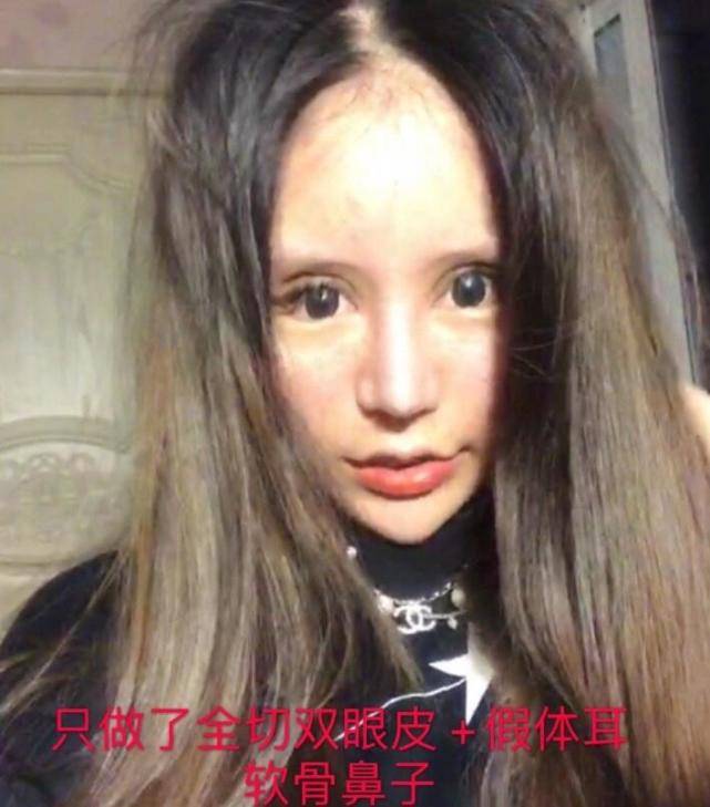 原創15歲女網紅花費400萬整容成癮天天曬照自認為很美網友吐槽像60歲