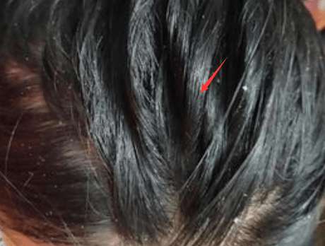 教你如何区分油性发质和干性发质 头发