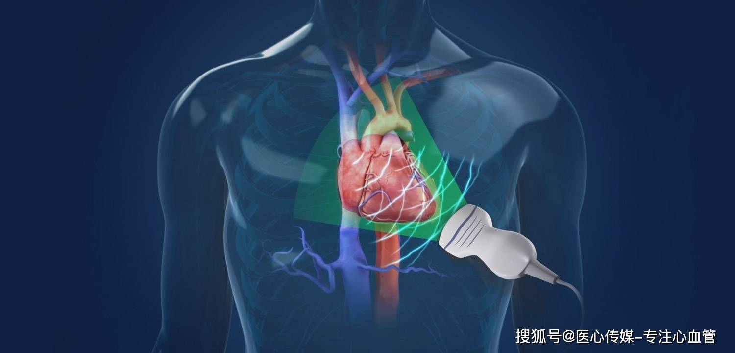 心脏介入医生应该掌握的超声心动图知识