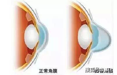 4683cecca42f41aba2855fa8d89cc334.jpeg