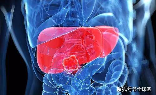 癌症新突破在哪治疗 21dafd557f244169bb95344db20aaf62.jpeg
