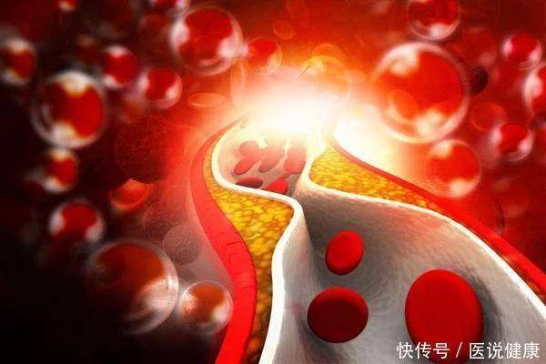 吃什么东西对心脏有好处 367ad6cd0e38416b9b80a9a6d8f40010.jpeg