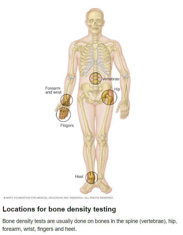 骨质疏松这个 沉默的杀手 如何正确对待 骨密度