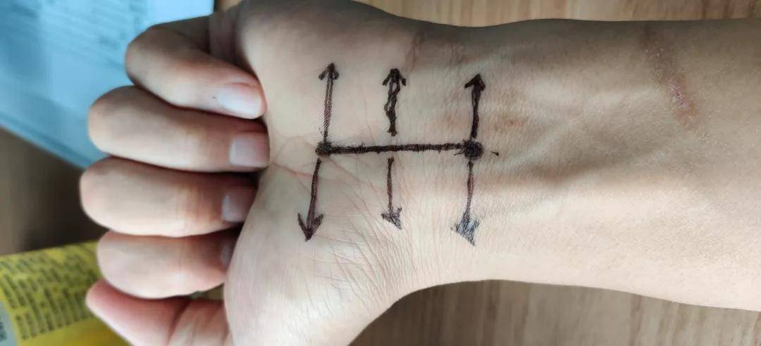 我叫"全穴",意为全能_穴位