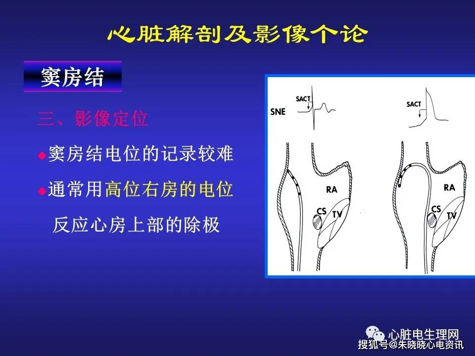 心臟電生理介入治療相關解剖影像學