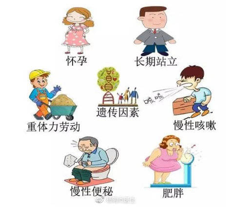 下肢静脉曲张喜欢这些人,你是其中一个吗?