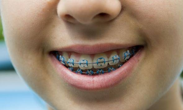 原创孩子长出了双排牙我太后悔了家长的无知会伤害孩子牙齿