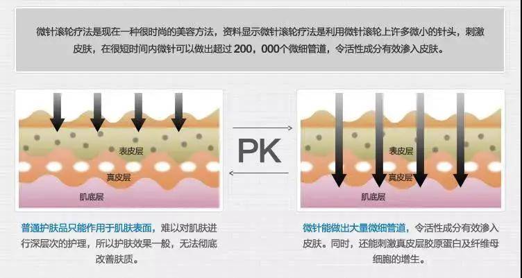 耳后止痛贴是什么原理_钱是万能止痛贴图片(3)