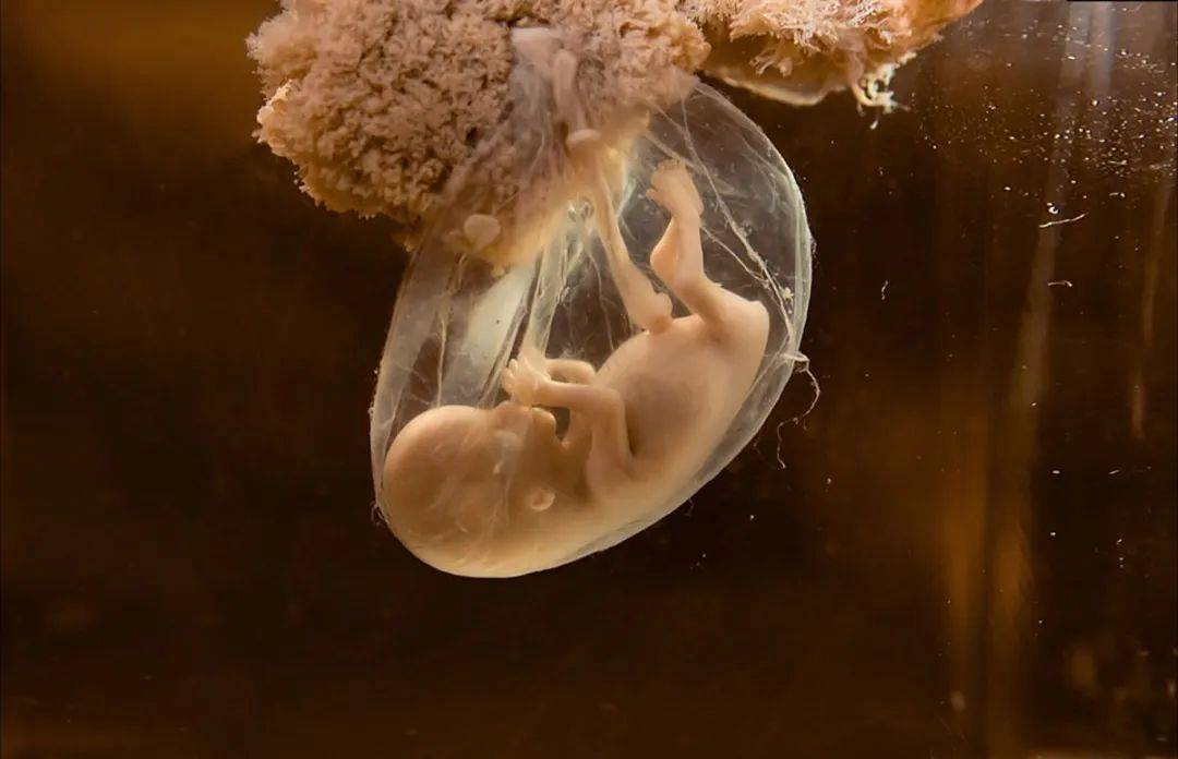 怀孕期间,胎儿智力发育高峰期有三个时间阶段,孕妈可要把握住了