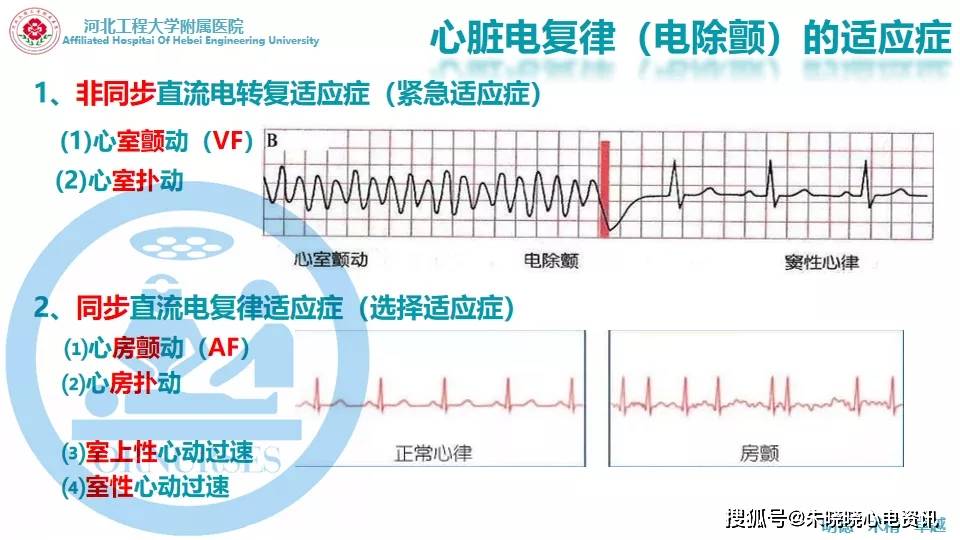 除颤仪的使用(ppt)