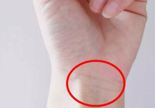 如果发现自己的手腕横纹往下3寸的地方,也就是内关穴的位置出现了青筋