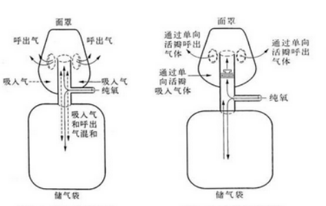 潮式呼吸发生的原理是什么_什么是腹式呼吸图解