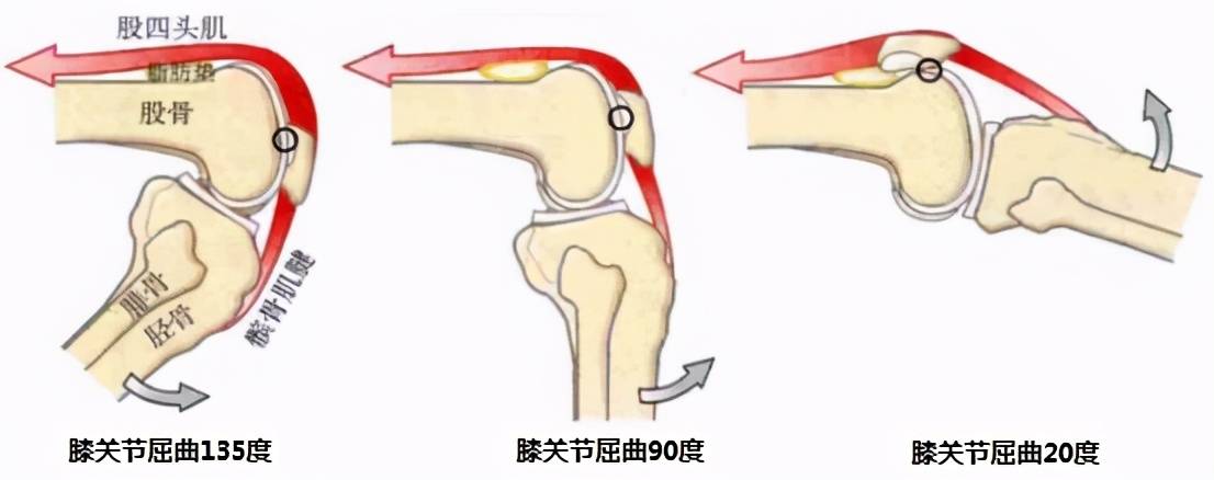 粗糙,後面為關節面,上端與股四頭肌相連,下端由髕韌帶固定於脛骨結