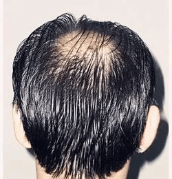 效果|熬夜修仙，快乐无边！但你的头发还要不要了？？