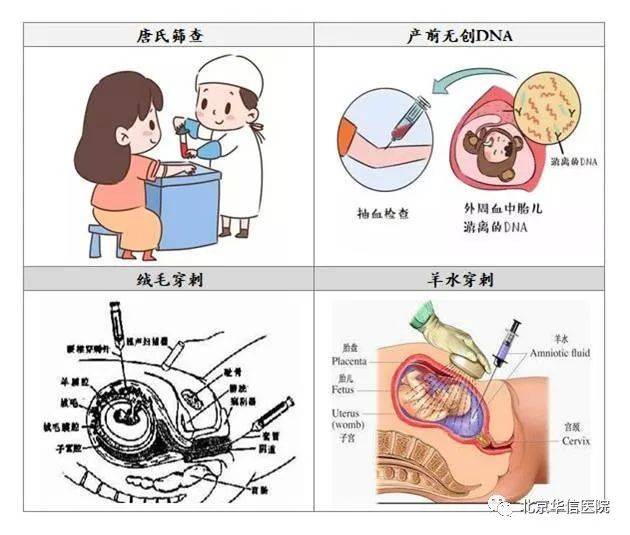 從羊水穿刺到兇險性前置胎盤產科為二胎媽媽驚心動魄的孕期保駕護航