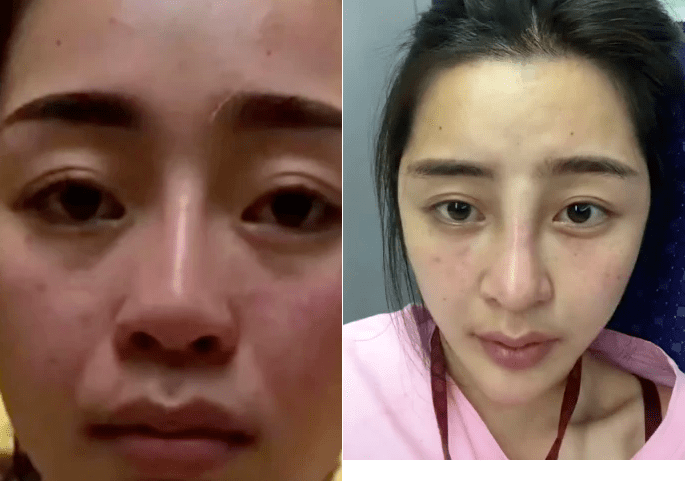 范冰冰脸有多吃香,网红用10年整成范冰冰,土妞"逆袭"成美女_苏雪儿