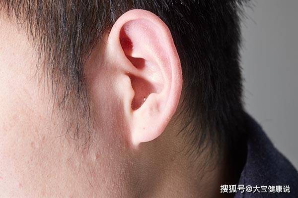 耳垂有折痕是什么问题啊 e12f8660a80a4e0ea4b3d1dd9cdfdbd0.jpeg