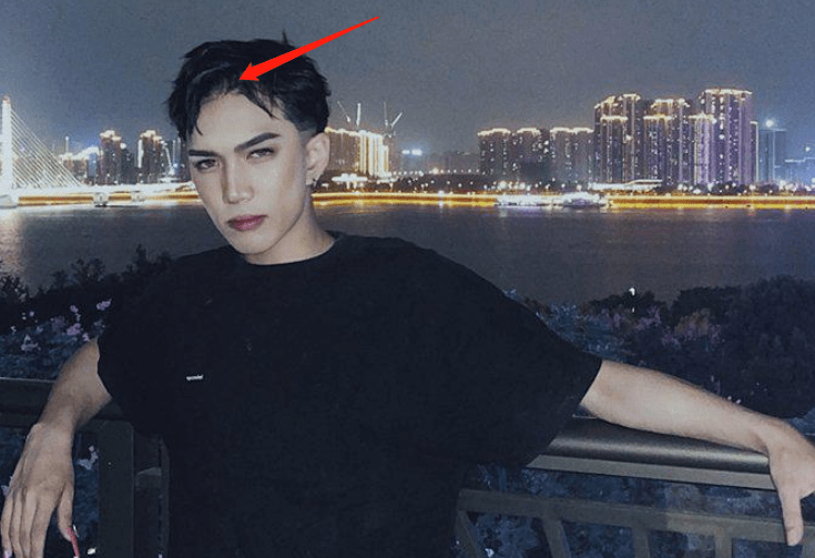 原创张彬彬发量引网友热议不少粉丝担心他未来会变秃