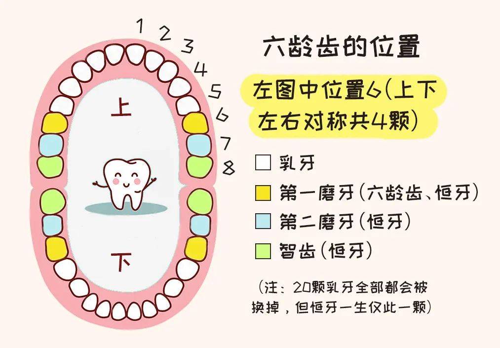 如果乳磨牙已經完成替換,那麼也可以根據實際情況考慮做窩溝封閉.