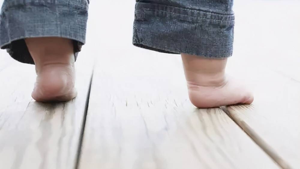 99%的"扁平足"可能都不需要治疗!严医生教你如何判断