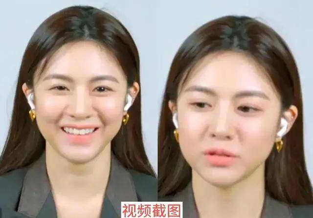 原创韩国氧气美女在动态视频中下垂苹果肌刀刻法令纹丑到没眼看