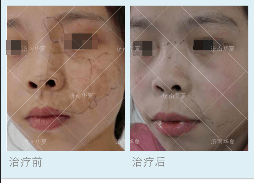 皮肤修复过程 f0bc87ab5a4d49b589f1e843bd897b01.png