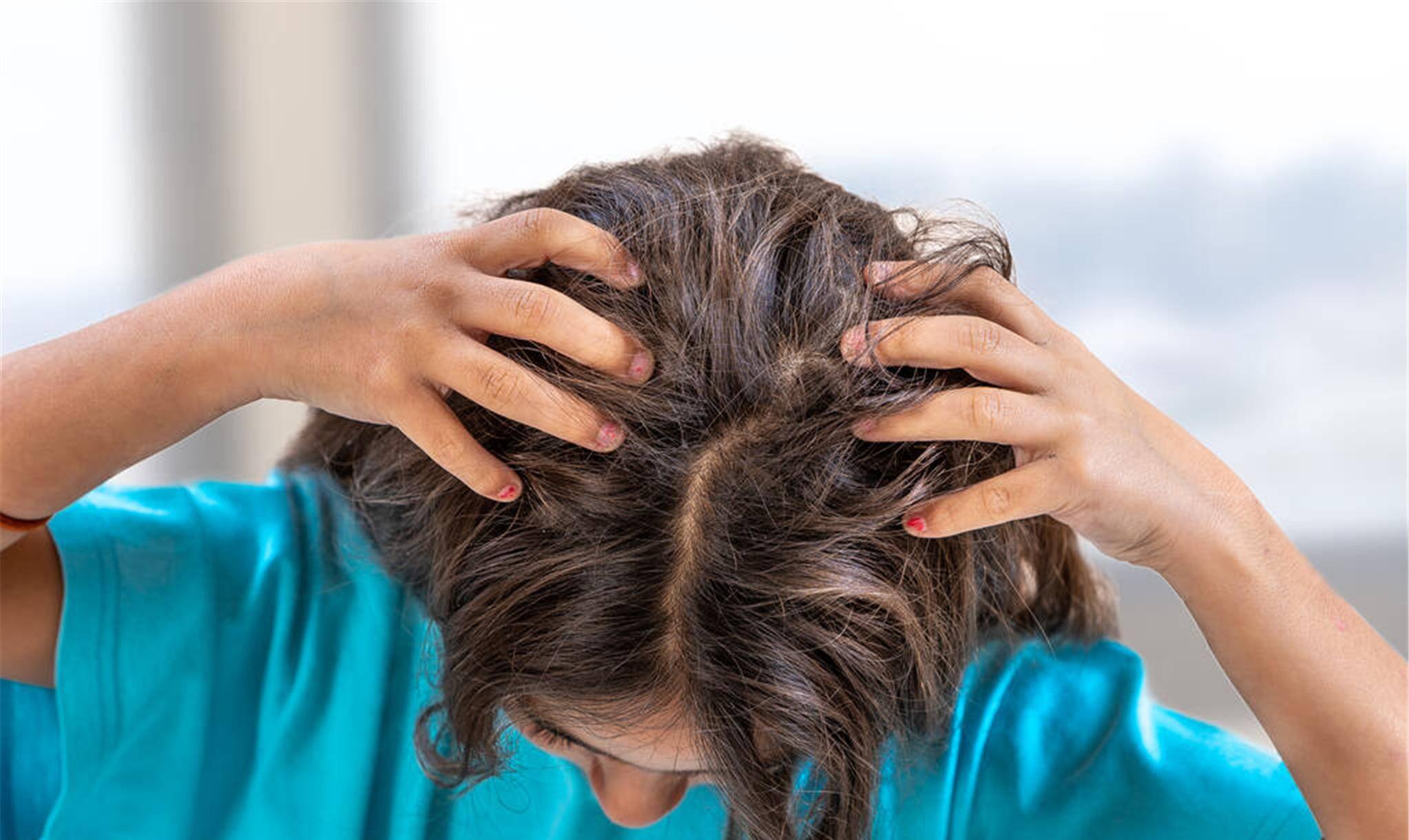 为何头皮里经常抠出 白泥 原因多半在自己身上,别不听劝