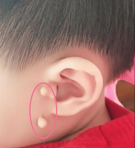 宝宝长"拴马桩"证明有福气?老旧思想不可信!