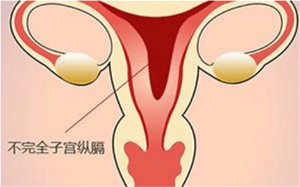 怀孕35周的刘姐患有纵膈子宫需要注意哪些事项