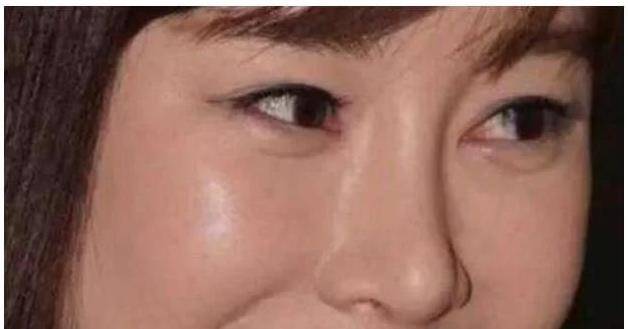 被玻尿酸毁了的女星娄艺潇脸部变形曹颖让人认不出第一个成妖