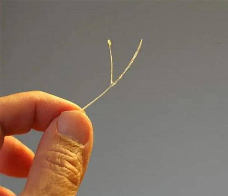 原创你们的果断救了孩子一命儿子鱼刺卡喉父母举动获医生称赞