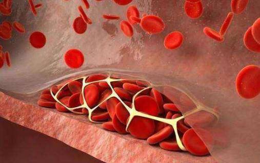 血脂怎么能降下去 6537ec5ffdb14d4f9fab4f8cf5c8aa02.jpeg