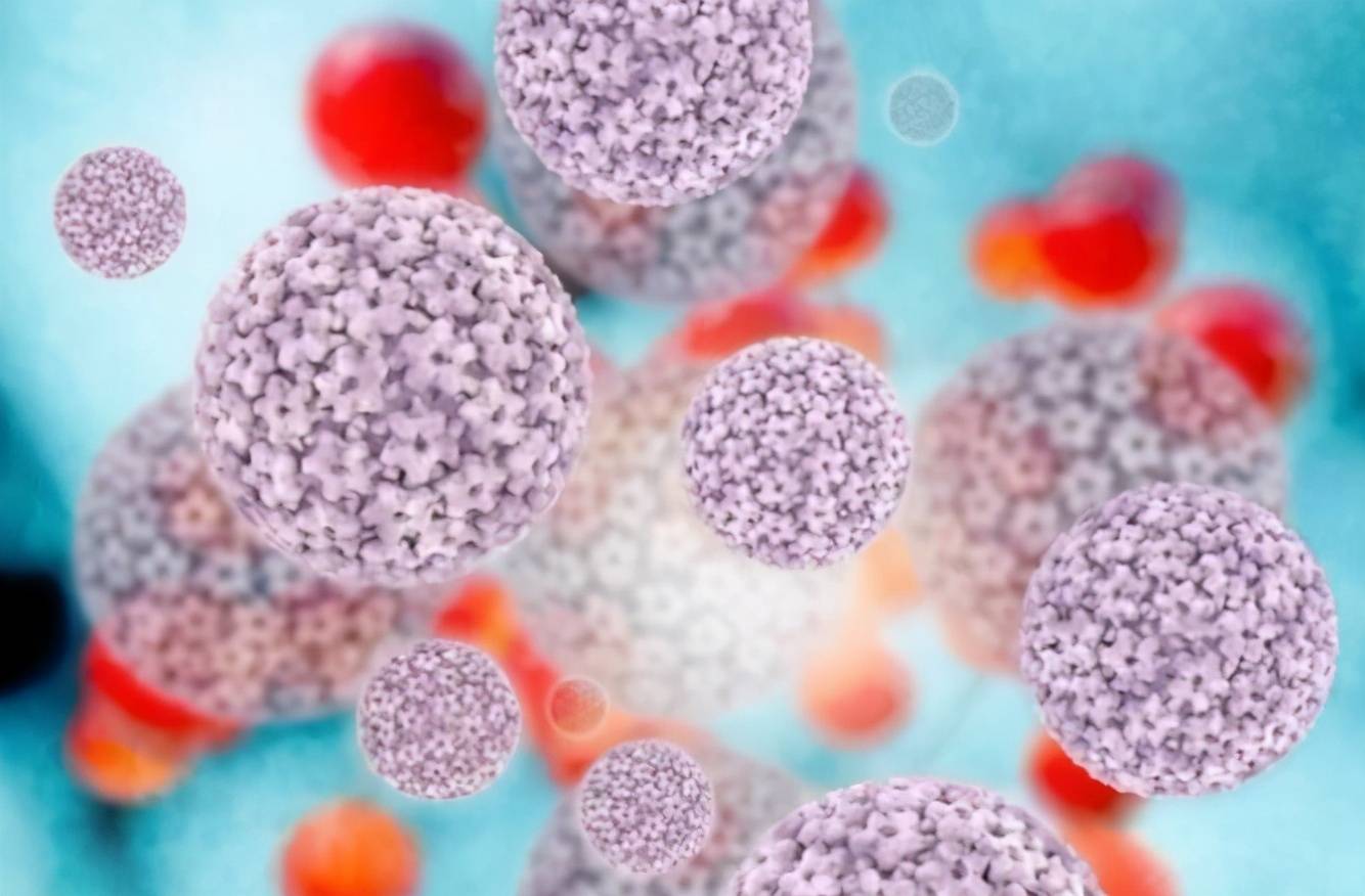 hpv感染是什么状况 1bdd2a6f681c43ad9233d0b977c1e6d1.jpeg