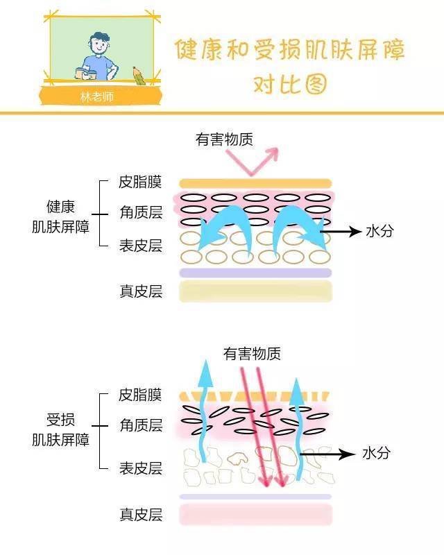 炎症阿澈达人：痘痘不及时护理？小心秒变痘痘肌！