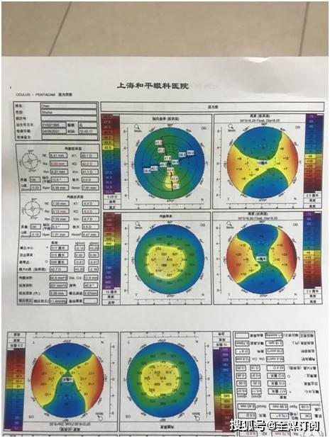 失而复得的清晰我在上海做icl晶体植入如何选择医生