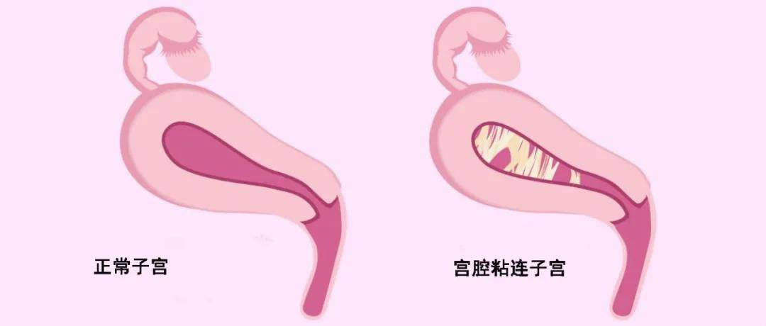 如何快速降低身体脂肪率 638cbff272f346b8ab5c18511760830b.jpeg