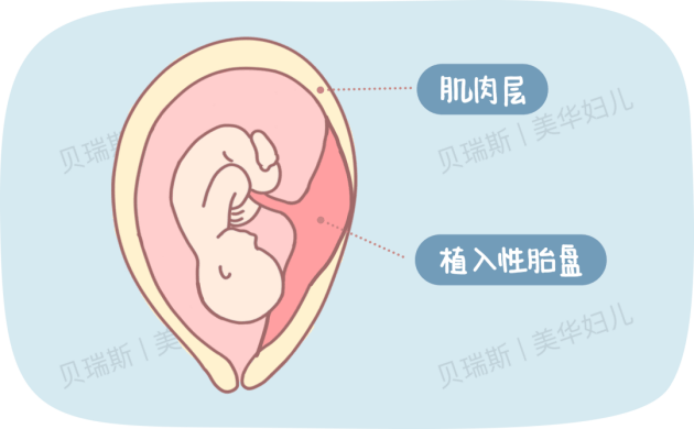 3b32cbf75ae54ce8b38c94e837380e53.png