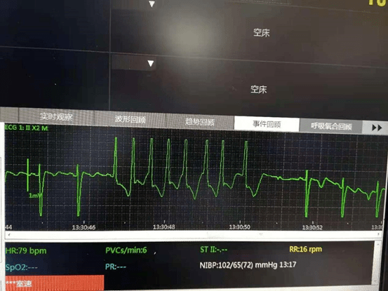 丨心的科普丨心電圖心臟彩超冠脈造影冠脈cta到底哪個能診斷冠心病