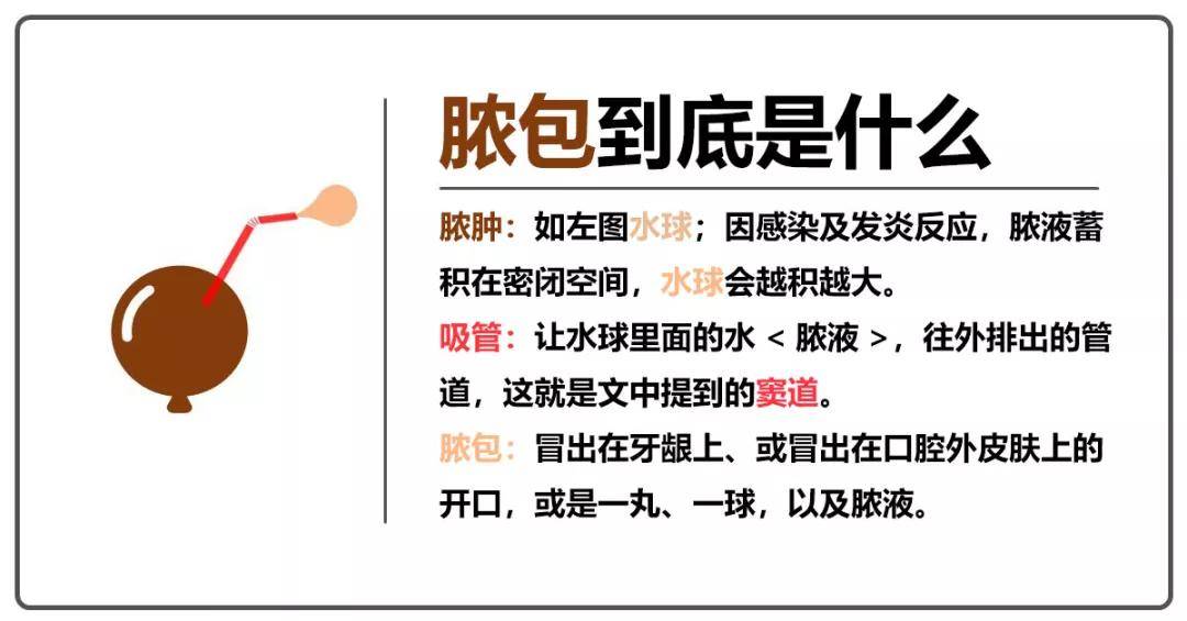 牙龈长脓包?请做到“二不一要”!