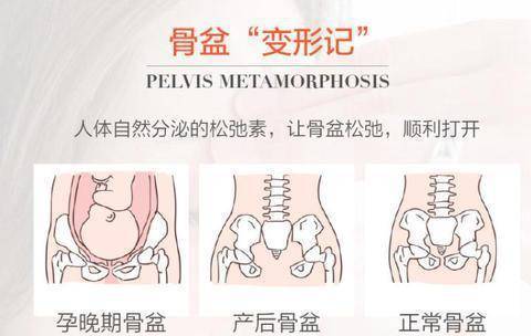 产后"骨盆"恢复很重要,产后妈妈们必须知道!