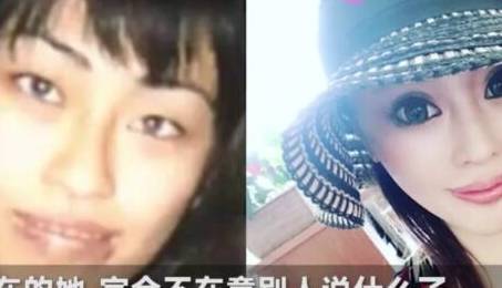 动刀|小时被妈妈嫌丑，女子砸200万整容300次，全身动刀，长这样漂亮吗